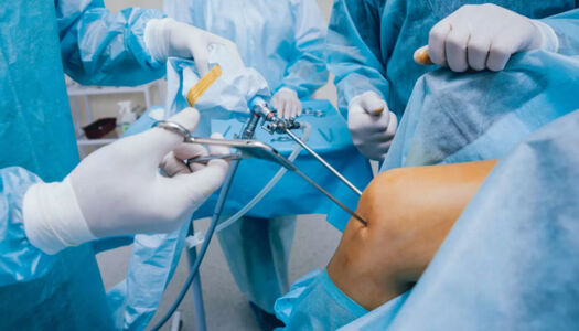 Arthroscopic surgery