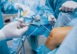 Chirurgie arthroscopique